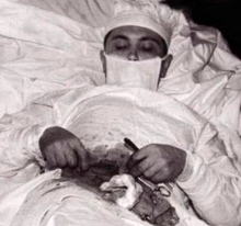 52 года назад хирург Леонид Рогозов сам себе вырезал аппендицит