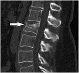 Мальчик из лагеря 'Росинка' попал в больницу