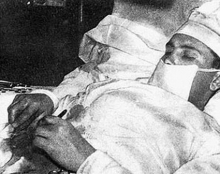 53 года назад в Арктике советский врач удалил себе аппендицит