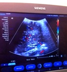 3D-технологии на вооружении врачей БСМП