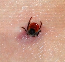 Энцефалитных клещей в Набережных Челнах пока не выявлено