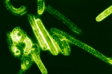 В Набережных Челнах у приезжего гостя из Нигерии обнаружили признаки лихорадки Эбола