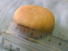 Необычная коллекция Айболитов из Набережных Челнов