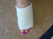 Работницы 'КАМАЗа' покалечили себе ноги