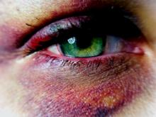 Спасатели два дня искали избитого кем-то рыбака