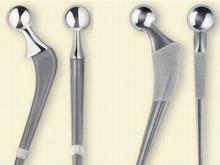 В Набережные Челны заказали 40 титановых эндопротезов на 1,9 миллиона рублей