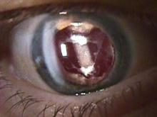 Частная клиника решила помочь членам общества слепых