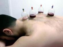 Житель Татарстана умер от процедуры кровопускания 'хиджама'