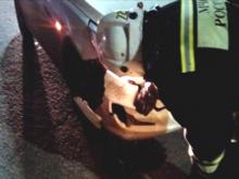 Сбитая машиной 10-летняя девочка сломала руку