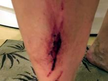 Василь Шайхразиев поддержал травмировавшегося на велосипеде губернатора Никиту Белых