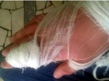 Конфликт в челнинском КВД: врачи и пациент не поняли друг друга