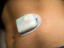 Искусственная поджелудочная железа для диабетиков появится на рынке к 2018 году