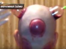 Амнистирован башкирский целитель, после процедуры кровопускания которого скончался татарстанец